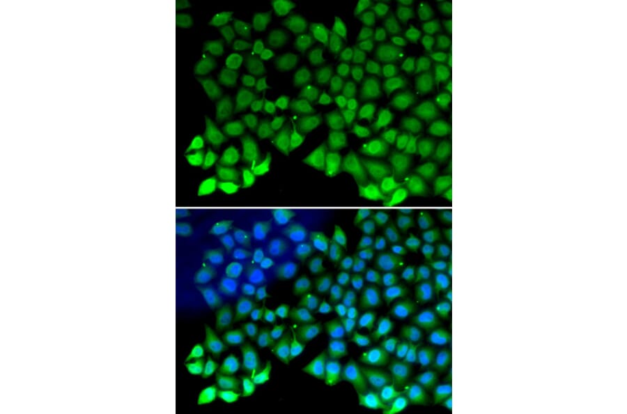 Immunofluorescence - RPA1 antibody from Signalway Antibody (38162) - Antibodies.com