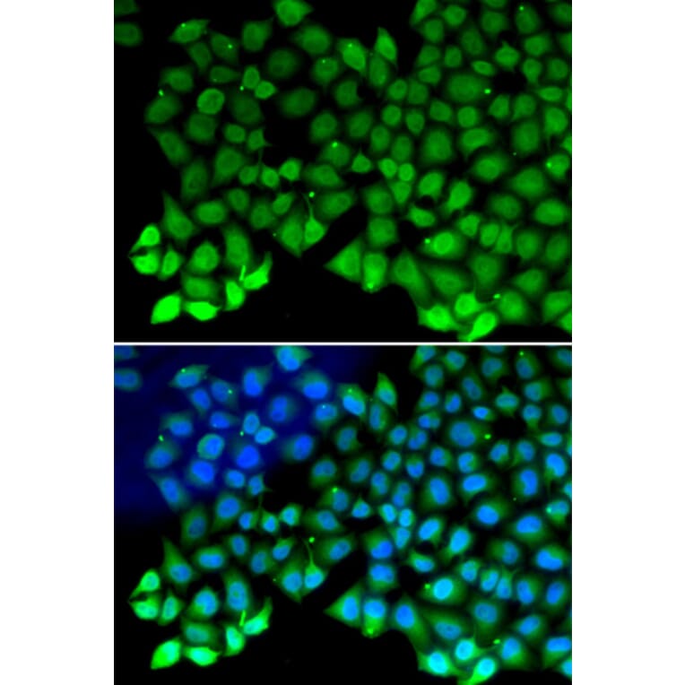 Immunofluorescence - RPA1 antibody from Signalway Antibody (38162) - Antibodies.com