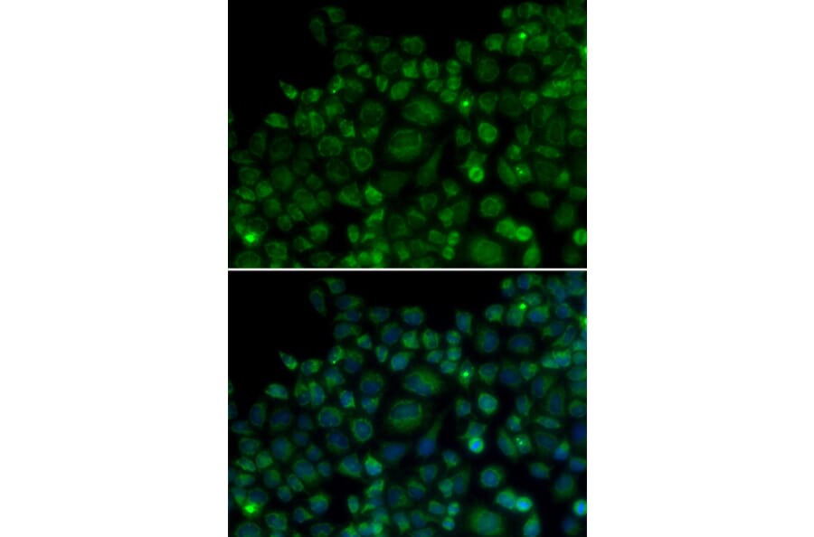 Immunofluorescence - TLR7 antibody from Signalway Antibody (38163) - Antibodies.com
