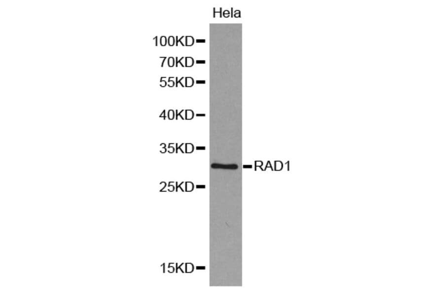 Western blot - RAD1 antibody from Signalway Antibody (38168) - Antibodies.com