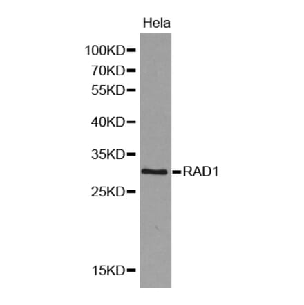 Western blot - RAD1 antibody from Signalway Antibody (38168) - Antibodies.com