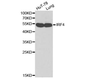 Western blot - IRF4 antibody from Signalway Antibody (38169) - Antibodies.com