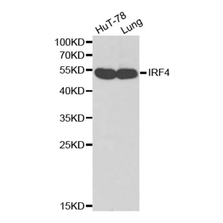 Western blot - IRF4 antibody from Signalway Antibody (38169) - Antibodies.com