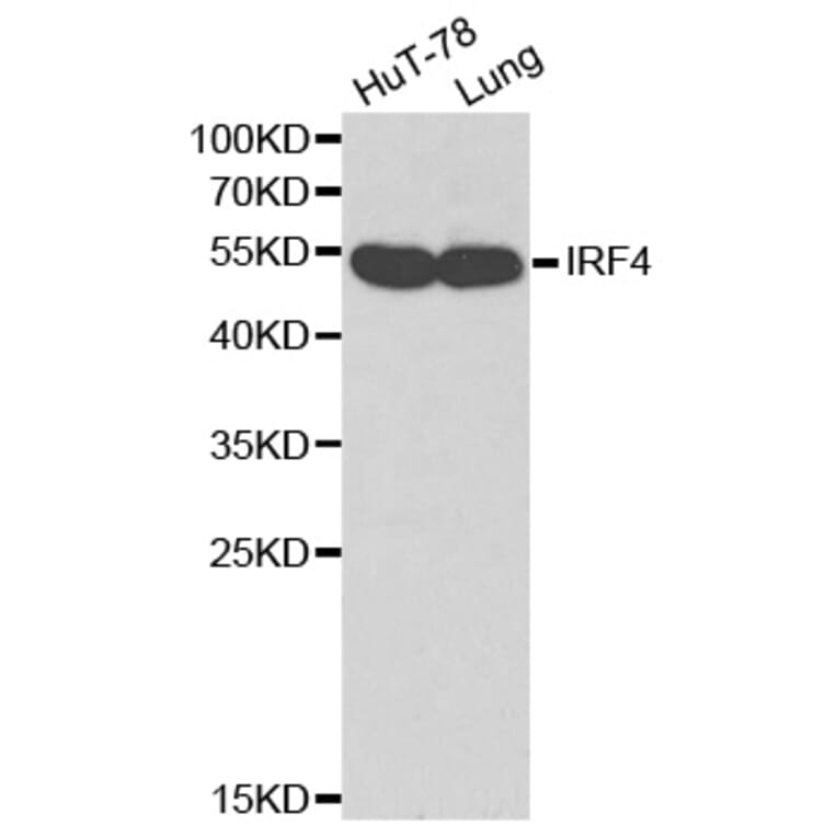 Western blot - IRF4 antibody from Signalway Antibody (38169) - Antibodies.com