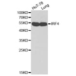 Western blot - IRF4 antibody from Signalway Antibody (38169) - Antibodies.com