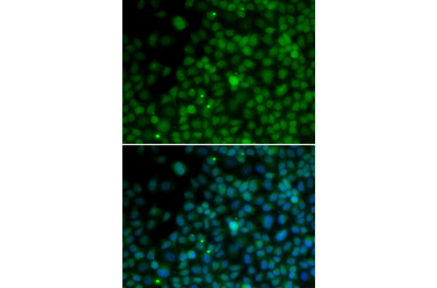 Immunofluorescence - IRF4 antibody from Signalway Antibody (38169) - Antibodies.com