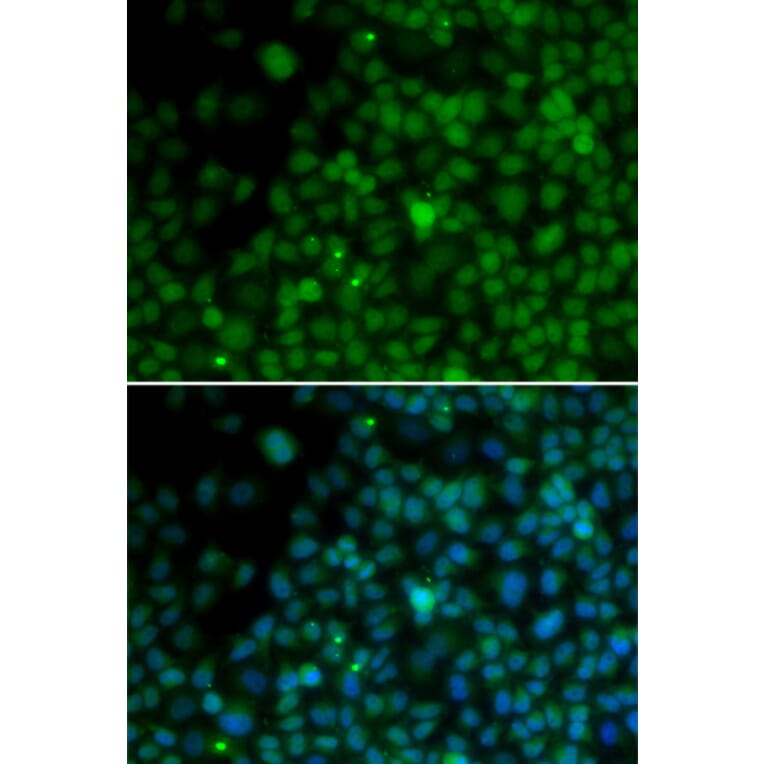 Immunofluorescence - IRF4 antibody from Signalway Antibody (38169) - Antibodies.com