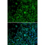 Immunofluorescence - IRF4 antibody from Signalway Antibody (38169) - Antibodies.com