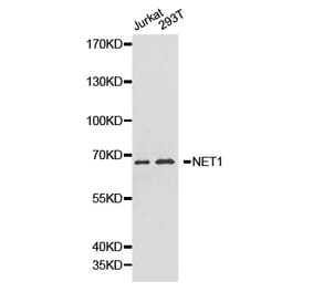 Western blot - NET1 antibody from Signalway Antibody (38218) - Antibodies.com