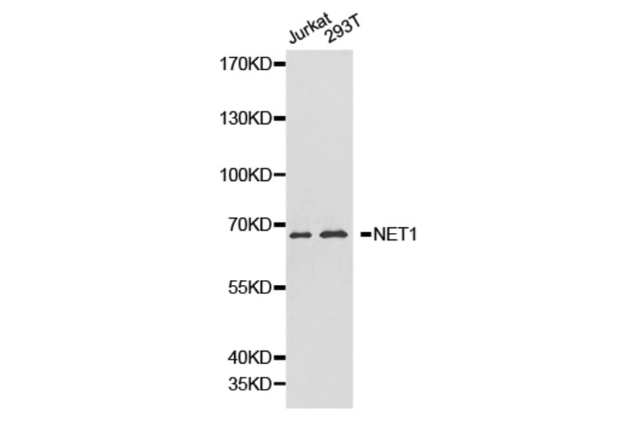 Western blot - NET1 antibody from Signalway Antibody (38218) - Antibodies.com