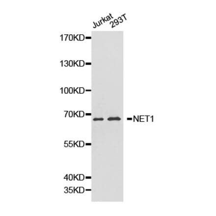 Western blot - NET1 antibody from Signalway Antibody (38218) - Antibodies.com