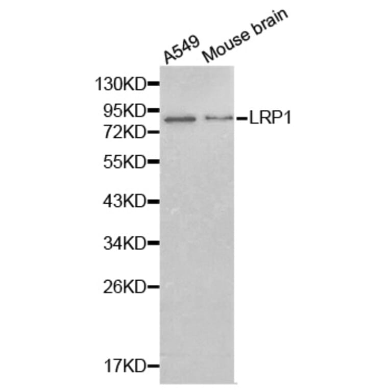 Western blot - LRP1 antibody from Signalway Antibody (38239) - Antibodies.com