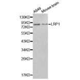 Western blot - LRP1 antibody from Signalway Antibody (38239) - Antibodies.com