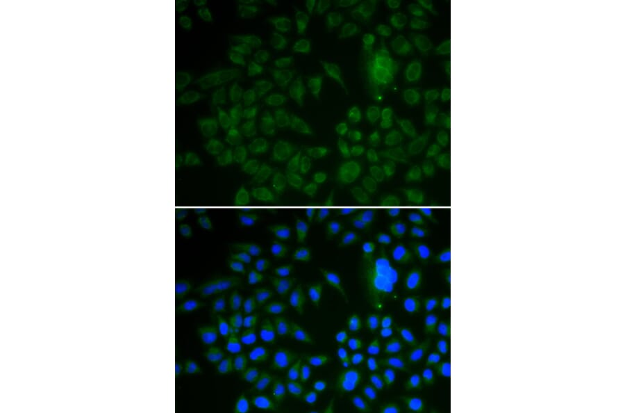 Immunofluorescence - LRP1 antibody from Signalway Antibody (38239) - Antibodies.com