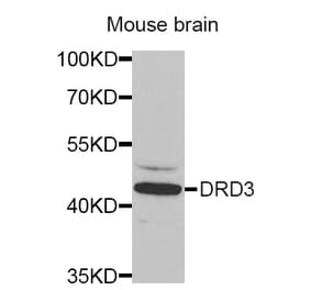 Western blot - DRD3 antibody from Signalway Antibody (38253) - Antibodies.com