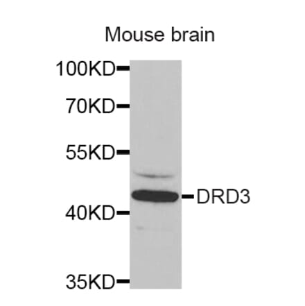 Western blot - DRD3 antibody from Signalway Antibody (38253) - Antibodies.com