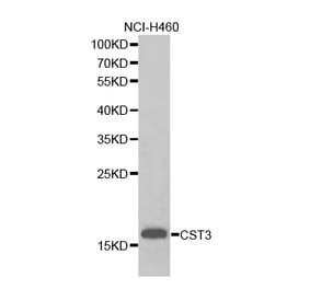 Western blot - CST3 antibody from Signalway Antibody (38255) - Antibodies.com