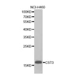 Western blot - CST3 antibody from Signalway Antibody (38255) - Antibodies.com