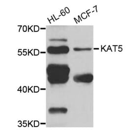 Western blot - KAT5 antibody from Signalway Antibody (38279) - Antibodies.com