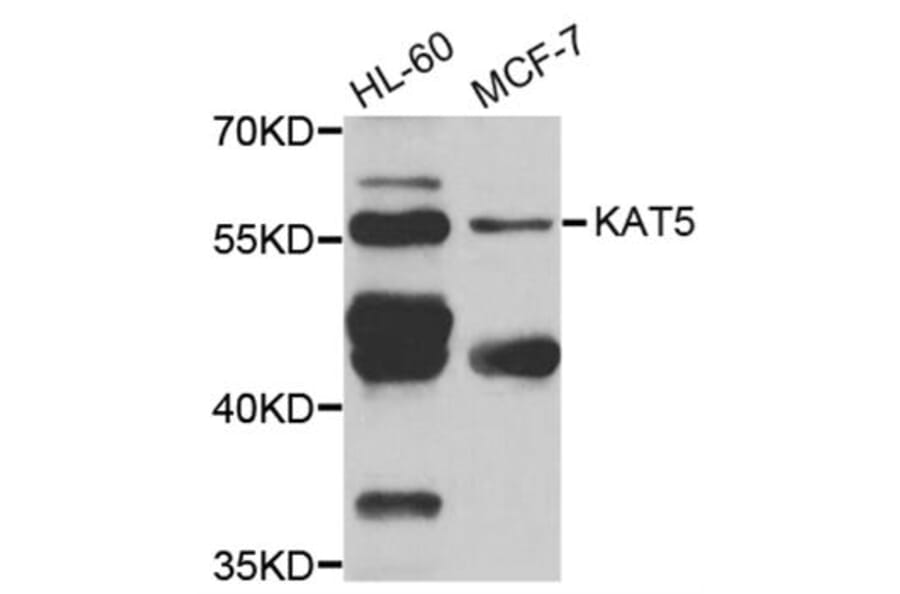 Western blot - KAT5 antibody from Signalway Antibody (38279) - Antibodies.com