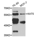 Western blot - KAT5 antibody from Signalway Antibody (38279) - Antibodies.com