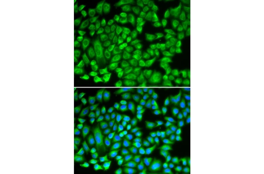 Immunofluorescence - KAT5 antibody from Signalway Antibody (38279) - Antibodies.com
