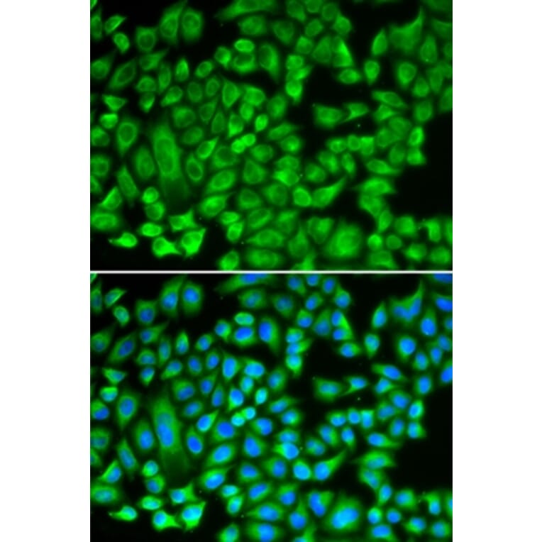 Immunofluorescence - KAT5 antibody from Signalway Antibody (38279) - Antibodies.com