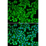 Immunofluorescence - KAT5 antibody from Signalway Antibody (38279) - Antibodies.com