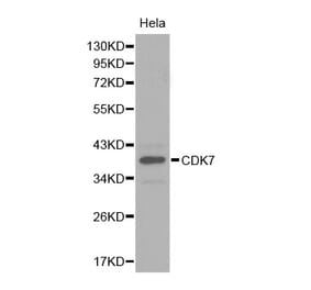 Western blot - CDK7 antibody from Signalway Antibody (38282) - Antibodies.com
