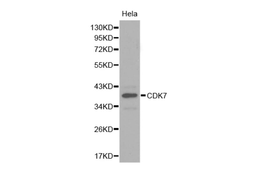 Western blot - CDK7 antibody from Signalway Antibody (38282) - Antibodies.com