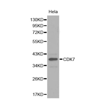 Western blot - CDK7 antibody from Signalway Antibody (38282) - Antibodies.com