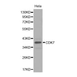 Western blot - CDK7 antibody from Signalway Antibody (38282) - Antibodies.com
