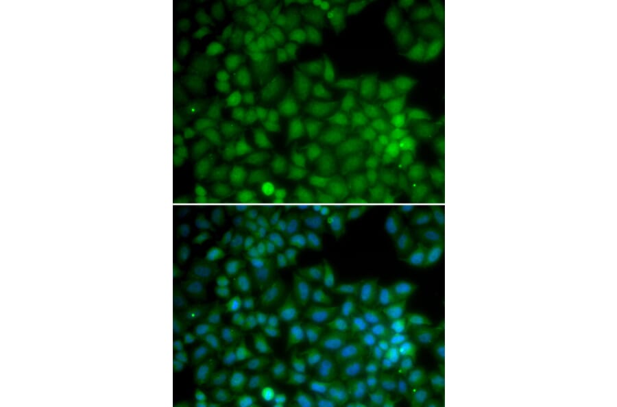 Immunofluorescence - CDK7 antibody from Signalway Antibody (38282) - Antibodies.com
