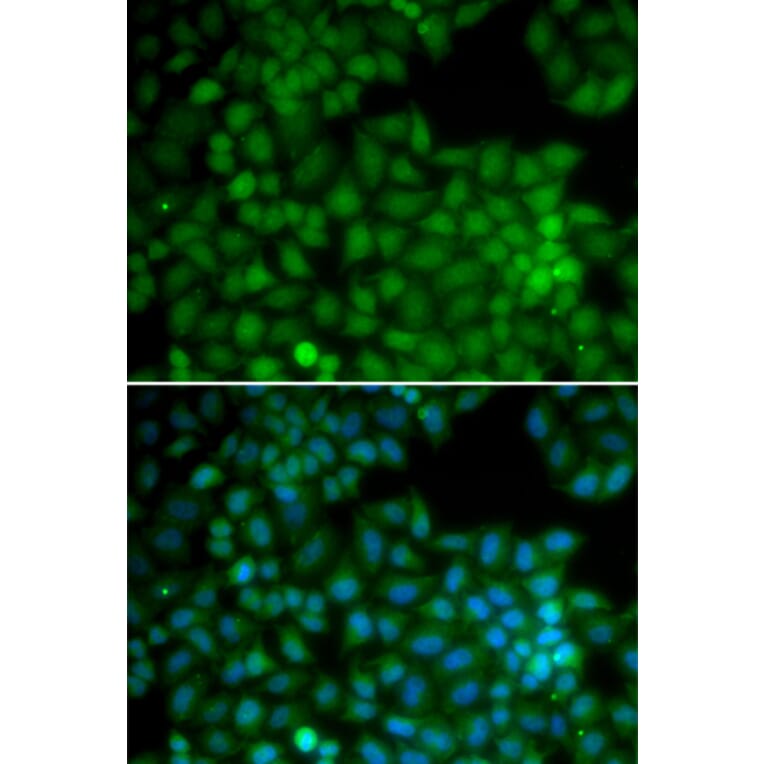 Immunofluorescence - CDK7 antibody from Signalway Antibody (38282) - Antibodies.com