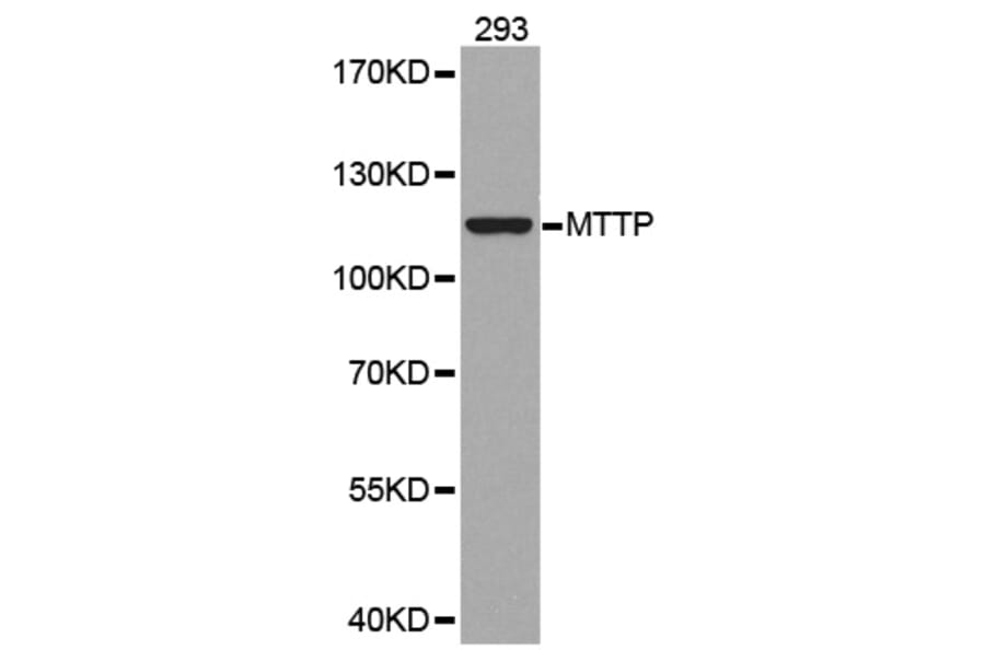 Western blot - MTTP antibody from Signalway Antibody (38292) - Antibodies.com