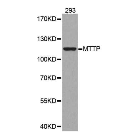 Western blot - MTTP antibody from Signalway Antibody (38292) - Antibodies.com