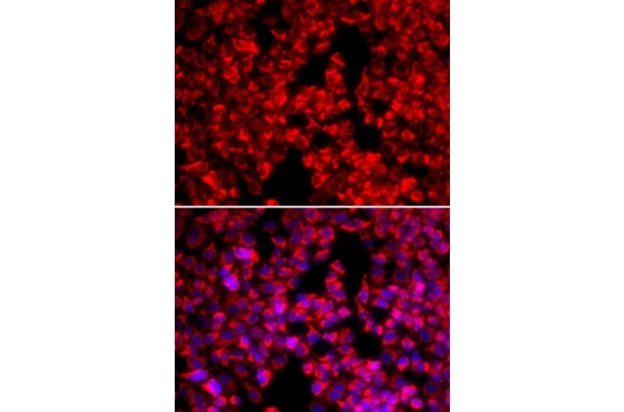 Immunofluorescence - MTTP antibody from Signalway Antibody (38292) - Antibodies.com