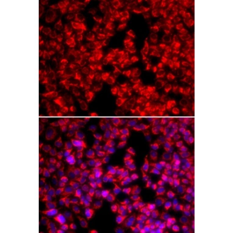 Immunofluorescence - MTTP antibody from Signalway Antibody (38292) - Antibodies.com