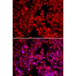 Immunofluorescence - MTTP antibody from Signalway Antibody (38292) - Antibodies.com