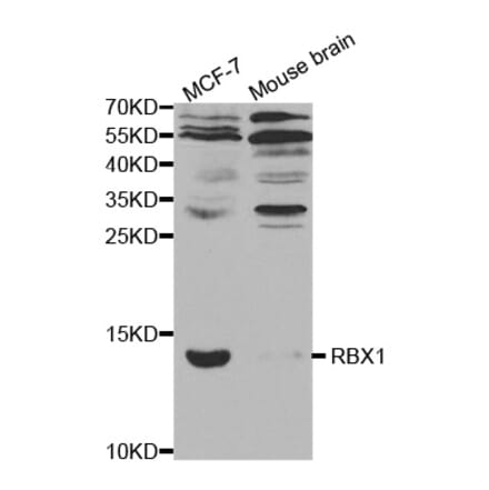 Western blot - RBX1 antibody from Signalway Antibody (38307) - Antibodies.com