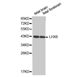 Western blot - LHX8 antibody from Signalway Antibody (38343) - Antibodies.com