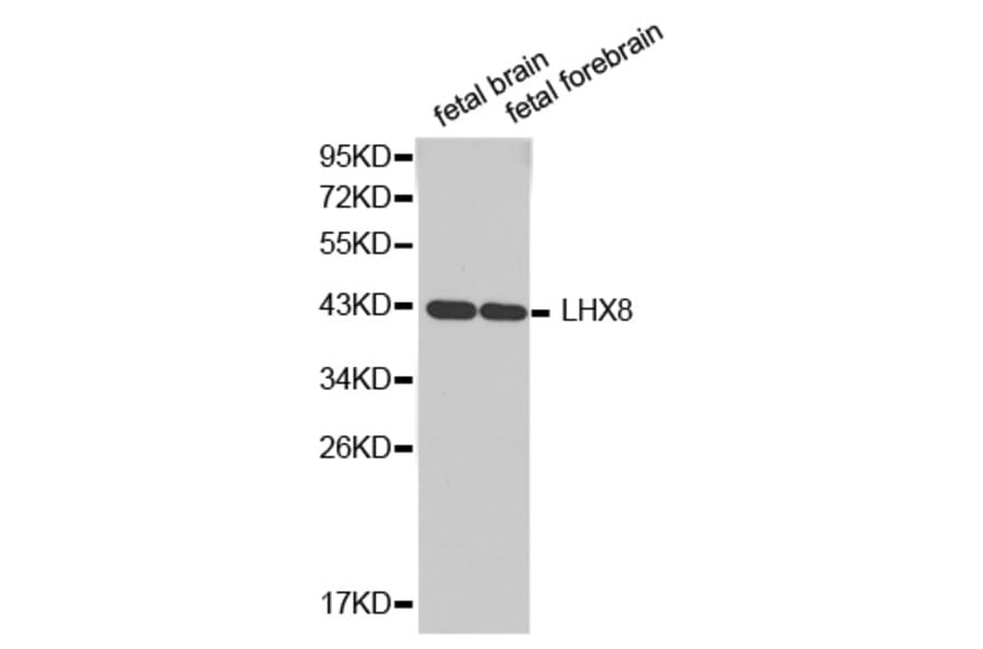 Western blot - LHX8 antibody from Signalway Antibody (38343) - Antibodies.com