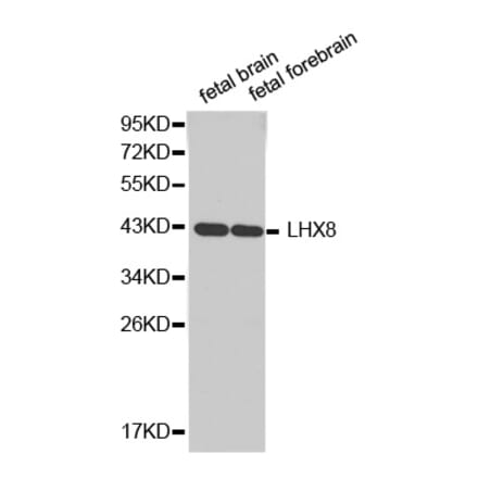 Western blot - LHX8 antibody from Signalway Antibody (38343) - Antibodies.com