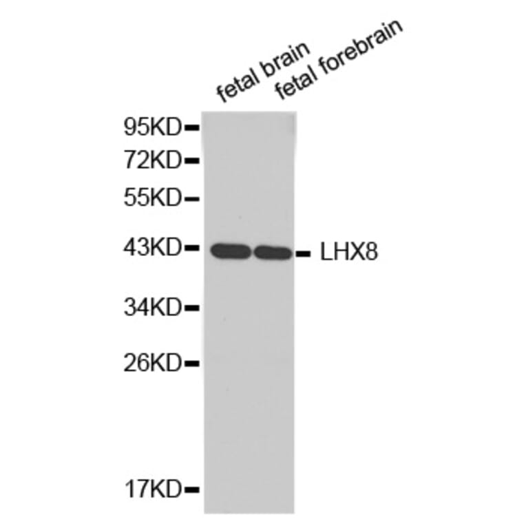 Western blot - LHX8 antibody from Signalway Antibody (38343) - Antibodies.com