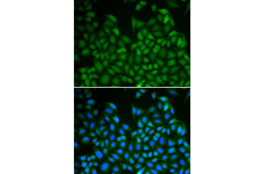 Immunofluorescence - LHX8 antibody from Signalway Antibody (38343) - Antibodies.com