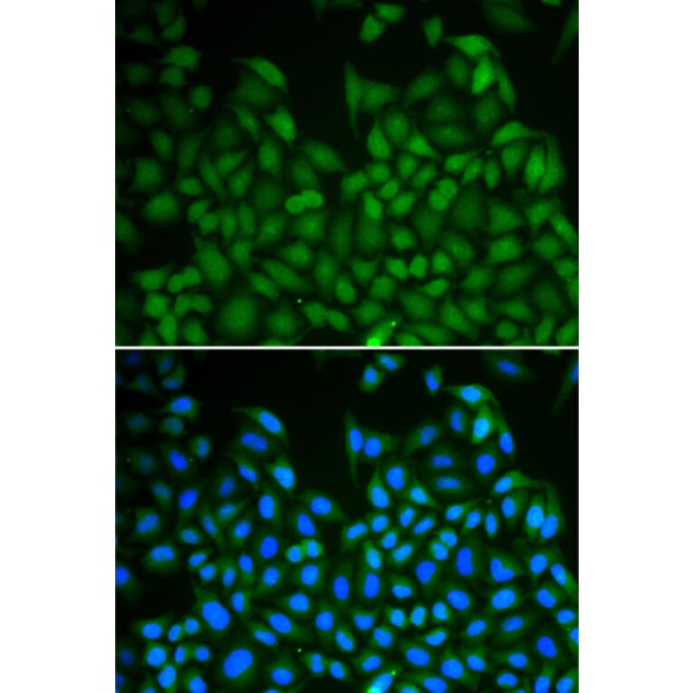 Immunofluorescence - LHX8 antibody from Signalway Antibody (38343) - Antibodies.com