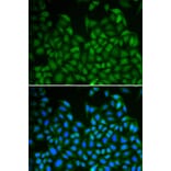 Immunofluorescence - LHX8 antibody from Signalway Antibody (38343) - Antibodies.com