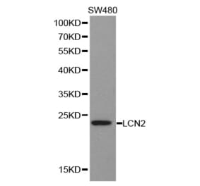 Western blot - LCN2 antibody from Signalway Antibody (38356) - Antibodies.com