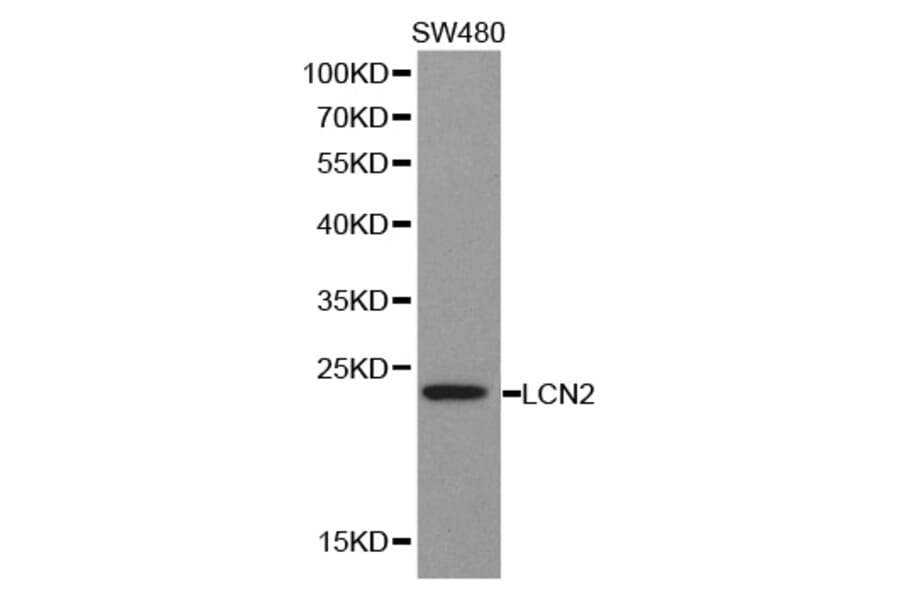 Western blot - LCN2 antibody from Signalway Antibody (38356) - Antibodies.com