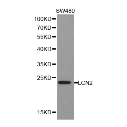Western blot - LCN2 antibody from Signalway Antibody (38356) - Antibodies.com